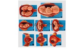 Gravidez Com 8 Fases - TGD-0339